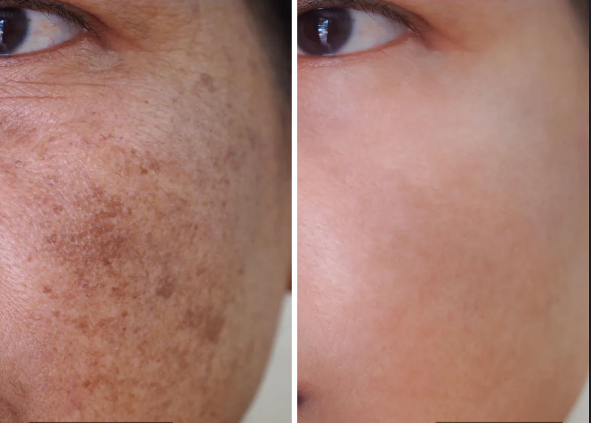 Collagen Cream